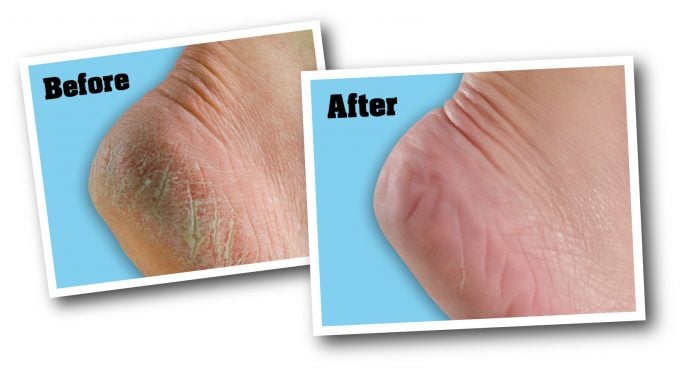 Crema hidratante para los pies - Imagen 2